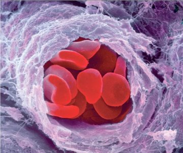 Electron microscope image of biological sample