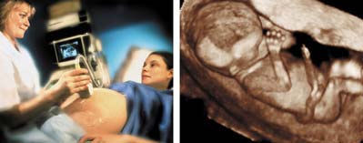 Ultrasound imaging in medicine