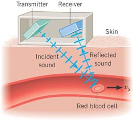 Doppler ultrasound measuring blood flow
