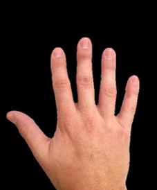 Right hand back