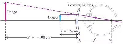 Ray diagram for correcting hyperopia with a converging lens