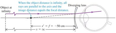 Ray diagram for correcting myopia with a diverging lens