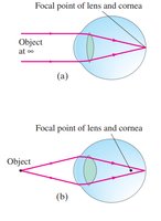 Focusing in the human eye