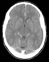 CT scan image