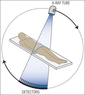 Schematic of a CT scan with rotating x-ray tube and detectors