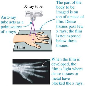 X-ray imaging of a hand and explanation of x-ray absorption
