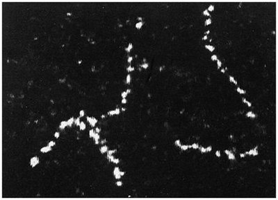 Electron micrograph showing chains of thorium atoms
