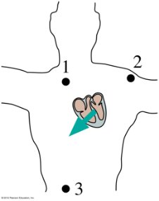 ECG electrode positions on chest