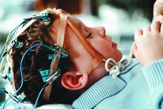 Electroencephalogram (EEG) measuring electric potentials in the brain