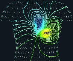 Equipotential lines and electric field vectors on the torso during a heartbeat
