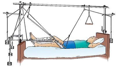 Traction system for static equilibrium