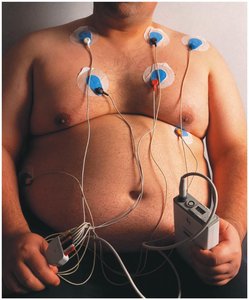 Bioelectric impedance analysis for measuring body fat
