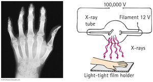 X-ray of a hand and X-ray tube diagram