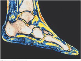 MRI scan of a foot