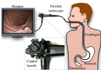 Medical endoscope showing internal imaging