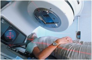 Cancer radiotherapy using high-energy electrons