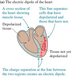Electric dipole of the heart