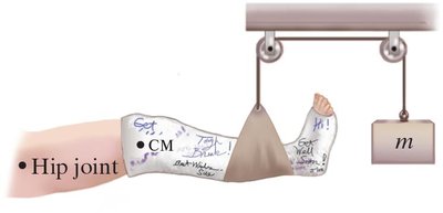Free-body diagram for leg suspension problem