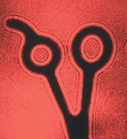 Single-slit diffraction pattern