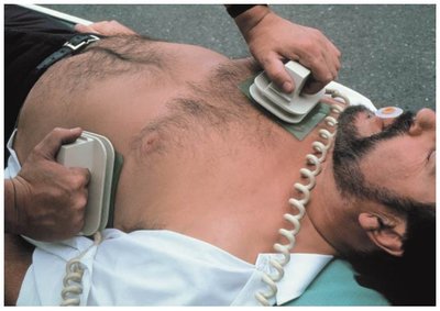 Defibrillator application