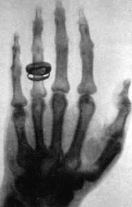 First X-ray image