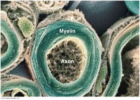 Cross-section of a myelinated axon