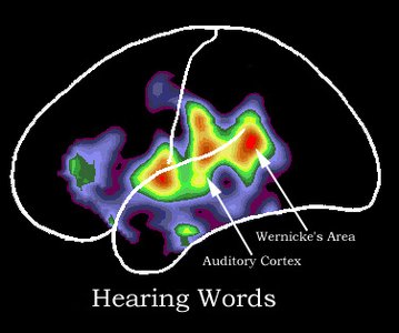 PET activation during hearing words (Wernicke's area)