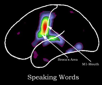 PET activation during speaking words (Broca's area)