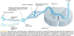 Diagram of neuropathic pain mechanisms