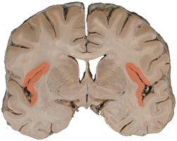 Gustatory cortex in the brain