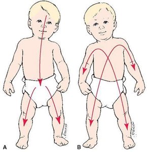 Cephalocaudal and proximodistal growth patterns in infants