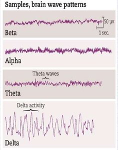 Brain wave patterns for different sleep stages