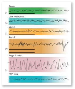 EEG patterns for sleep stages