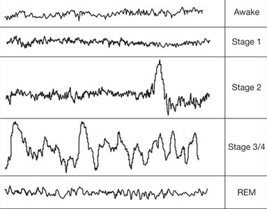 EEG patterns for sleep stages