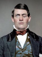 Portrait of Phineas Gage