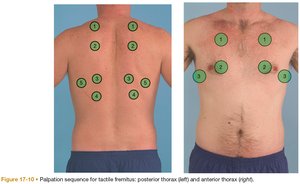 Palpation sequence for tactile fremitus on posterior and anterior thorax.