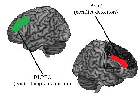 Brain diagram showing DLPFC and ACC regions