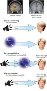 Fear conditioning and the brain