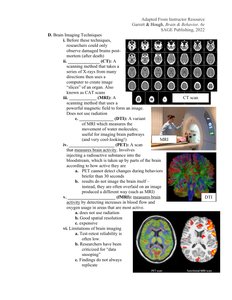 CT, MRI, and DTI brain imaging examples