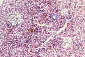Pancreatic histology: acini and islets