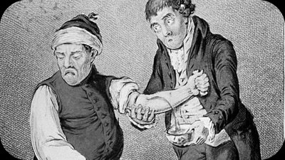 Historical depiction of bloodletting as treatment