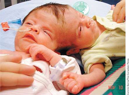 Twins representing gene-environment interaction