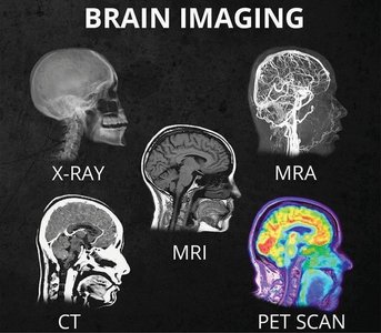 Brain imaging techniques: X-ray, MRI, MRA, CT, PET scan