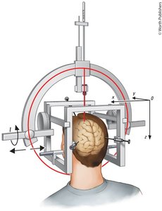 Stereotaxic apparatus for brain surgery