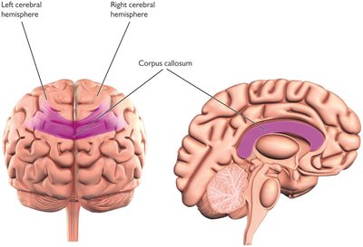 Corpus callosum connection