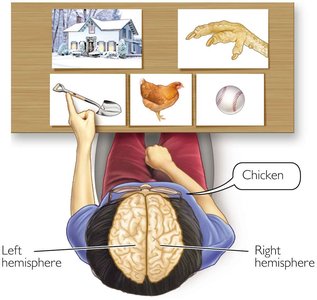 Split brain surgery diagram