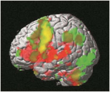 fMRI brain activity