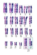 Human karyotype showing 23 pairs of chromosomes