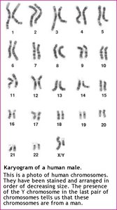 Karyogram of a human male