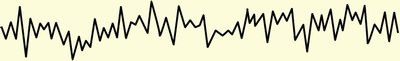 EEG for Stage 1 sleep